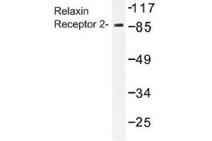 Image no. 1 for anti-Relaxin/insulin-Like Family Peptide Receptor 2 (RXFP2) antibody (ABIN317772) (RXFP2 anticorps)