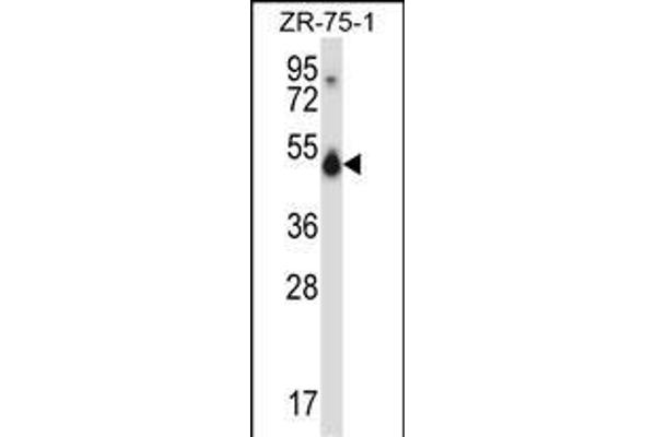 CELF1 anticorps  (N-Term)