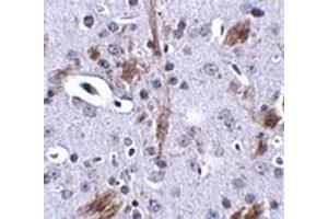 Immunohistochemistry (IHC) image for anti-tau Tubulin Kinase 1 (Ttbk1) (C-Term) antibody (ABIN1030783) (TTBK1 anticorps  (C-Term))