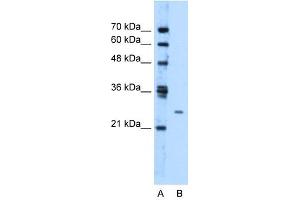 TMEM126B antibody used at 1. (TMEM126B anticorps  (Middle Region))