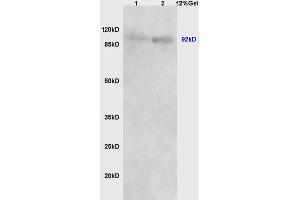 SDS-PAGE (SDS) image for anti-Catenin, beta (CATNB) (AA 661-781) antibody (ABIN738621)