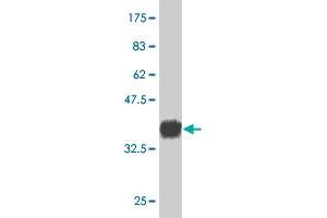 Western Blot detection against Immunogen (37. (CD34 anticorps  (AA 32-141))