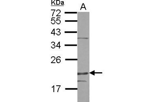 Density Regulated Protein anticorps  (AA 1-198)