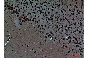 Immunohistochemical analysis of paraffin-embedded Mouse-brain, antibody was diluted at 1:100. (Pleiotrophin anticorps  (Internal Region))