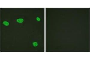 Immunofluorescence analysis of HeLa cells, using Vitamin D Receptor (Ab-208) Antibody. (Vitamin D Receptor anticorps  (AA 181-230))