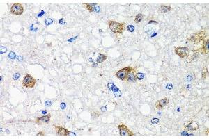 Immunohistochemistry of paraffin-embedded Rat brain using ACVR1C Polyclonal Antibody at dilution of 1:100 (40x lens). (ACVR1C/ALK7 anticorps)