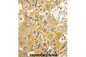 Immunohistochemistry (IHC) image for anti-Calcium/calmodulin-Dependent Protein Kinase ID (CAMK1D) antibody (ABIN3003043) (CAMK1D anticorps)