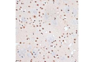 Immunohistochemistry of paraffin-embedded mouse brain using RBM3 antibody  at dilution of 1:100 (40x lens). (RBM3 anticorps  (AA 1-157))