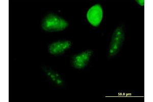 Immunofluorescence of monoclonal antibody to GCM1 on HeLa cell. (GCM1 anticorps  (AA 108-166))