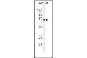 Western blot analysis of GAB4 Antibody (GAB4 anticorps  (N-Term))