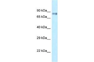 WB Suggested Anti-Lrrfip1 Antibody Titration: 1. (LRRFIP1 anticorps  (C-Term))