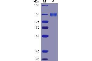 Human Protein, mFc Tag on SDS-PAGE under reducing condition. (ACE2 Protein (AA 18-740) (mFc Tag))