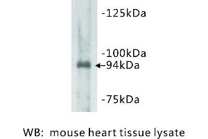 Image no. 1 for anti-Junctophilin 2 (JPH2) antibody (ABIN1112815) (Junctophilin 2 anticorps)