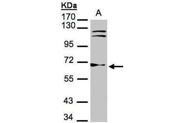 TXNRD1 anticorps