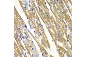 Immunohistochemistry of paraffin-embedded rat heart using TYR antibody. (TYR anticorps)