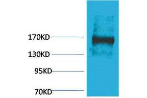 Western Blotting (WB) image for anti-Ectopic P-Granules Autophagy Protein 5 Homolog (EPG5) antibody (ABIN3181524) (EPG5 anticorps)