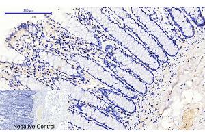 Immunohistochemical analysis of paraffin-embedded human colon tissue. (JAK1 anticorps  (pTyr1022))