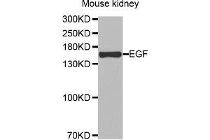 Western Blotting (WB) image for anti-Epidermal Growth Factor (EGF) antibody (ABIN6219771) (EGF anticorps)