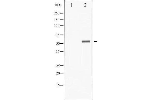 CHEK1 anticorps  (pSer301)