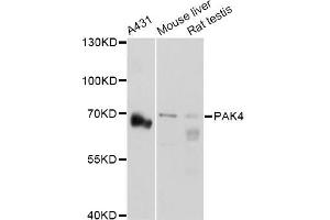 Western blot analysis of extracts of various cell lines, using PAK4 Antibody (ABIN5971470) at 1:3000 dilution. (PAK4 anticorps)