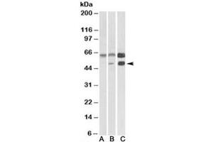 Western blot testing of human cerebellum [A], mouse brain [B], and rat brain [C] lysates with CAMK2A antibody at 0. (CAMK2A anticorps)