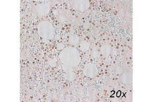 Human bone marrow, paraffin section, citrate, dilution 3 µg/mL (Lipocalin 2 anticorps)