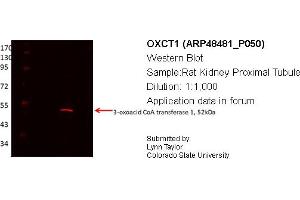 Western Blotting (WB) image for anti-3-Oxoacid CoA Transferase 1 (OXCT1) (Middle Region) antibody (ABIN311042) (OXCT1 anticorps  (Middle Region))