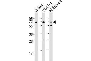 Lane 1: Jurkat Cell lysates, Lane 2: MOLT-4 Cell lysates, Lane 3: mouse thymus Cell lysates, probed with Zap70 (1484CT290. (ZAP70 anticorps)