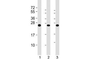 Western blot testing of human 1) A431, 2) HL-60 and 3) U2OS cell lysate with RAB5C antibody at 1:2000. (Rab5c anticorps)