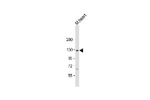 Western Blot at 1:2000 dilution + mouse heart lysate Lysates/proteins at 20 ug per lane. (NLRP6 anticorps  (AA 343-372))