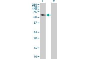 Western Blot analysis of SMAD6 expression in transfected 293T cell line by SMAD6 MaxPab polyclonal antibody. (SMAD6 anticorps  (AA 1-496))