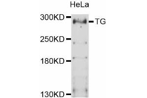 Western blot analysis of extracts of HeLa cells, using TG antibody (ABIN5999034) at 1:3000 dilution. (Thyroglobulin anticorps)