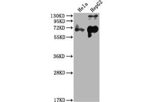 Western Blot Positive WB detected in: Hela whole cell lysate, HepG2 whole cell lysate All lanes: YAP1 antibody at 1:2000 Secondary Goat polyclonal to rabbit IgG at 1/50000 dilution Predicted band size: 55, 53, 49, 37, 49, 50, 51, 54 kDa Observed band size: 65 kDa (YAP1 anticorps  (AA 155-504))