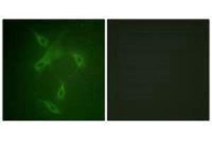 Immunofluorescence analysis of NIH/3T3 cells, using JAK2 (Ab-570) antibody. (JAK2 anticorps  (Tyr570))