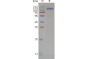 Human Protein, hFc Tag on SDS-PAGE under reducing condition. (E-cadherin Protein (AA 23-706) (Fc Tag))