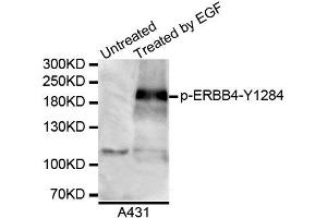 Western blot analysis of extracts of A431 cell line, using Phospho-ERBB4-Y1284 antibody. (ERBB4 anticorps  (pTyr1284))