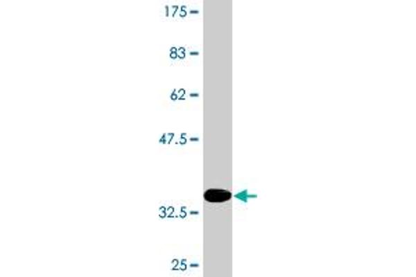 Calcitonin Receptor anticorps  (AA 394-474)