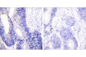 Peptide - +Immunohistochemical analysis of paraffin-embedded human colon carcinoma tissue using Claudin 3 antibody. (Claudin 3 anticorps)