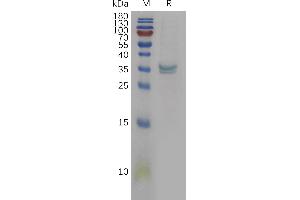 PPT1 Protein (AA 28-306) (His tag)