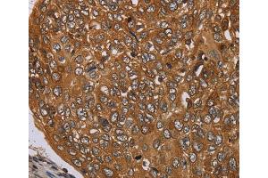 Immunohistochemistry (IHC) image for anti-Pim-3 Oncogene (PIM3) antibody (ABIN2434924) (PIM3 anticorps)