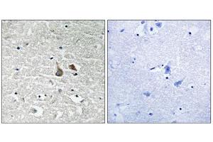 Immunohistochemistry analysis of paraffin-embedded human brain tissue using IRAK1 (Phospho-Ser376) antibody. (IRAK1 anticorps  (pSer376))