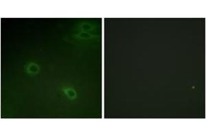 Immunofluorescence analysis of HeLa cells, using CXCR4 (Phospho-Ser339) Antibody. (CXCR4 anticorps  (pSer339))