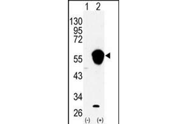 ALDH3A1 anticorps  (N-Term)