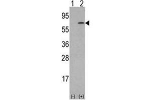 Western blot analysis of M-CSF (arrow) using rabbit polyclonal M-CSF Antibody (Center) . (M-CSF/CSF1 anticorps  (Middle Region))