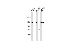 Western Blot at 1:2000 dilution Lane 1: A549 whole cell lysate Lane 2: HepG2 whole cell lysate Lane 3: MCF-7 whole cell lysate Lysates/proteins at 20 ug per lane. (Klotho beta anticorps  (AA 1-29))