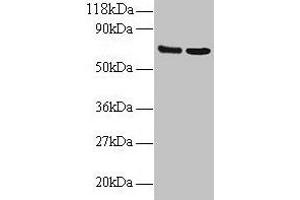 Western blot All lanes: IFITM1 antibody at 2 μg/mL Lane 1: EC109 whole cell lysate Lane 2: 293T whole cell lysate Secondary Goat polyclonal to rabbit IgG at 1/15000 dilution Predicted band size: 14 kDa Observed band size: 70 kDa (IFITM1 anticorps  (AA 1-36))