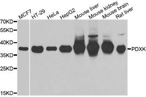 Western blot analysis of extracts of various cell lines, using PDXK antibody (ABIN5974032) at 1/1000 dilution. (PDXK anticorps)