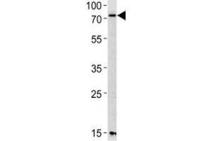 Western blot analysis of lysate from mouse NIH3T3 cell line using PAK3 antibody diluted at 1:1000 for each lane. (PAK3 anticorps  (AA 124-152))