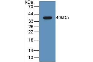 Detection of Recombinant GHRH, Human using Monoclonal Antibody to Growth Hormone Releasing Hormone (GHRH) (GHRH anticorps  (AA 19-108))