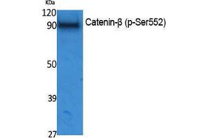 Western Blotting (WB) image for anti-Catenin, beta (CATNB) (pSer552) antibody (ABIN3173575) (beta Catenin anticorps  (pSer552))